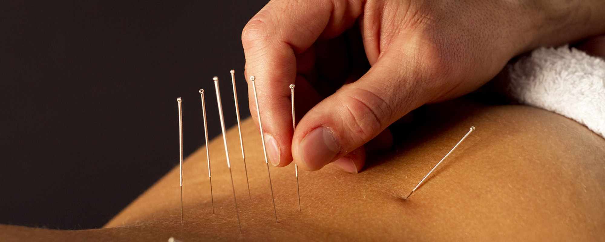 Osteopatia e Acupuntura - Nelson Costa