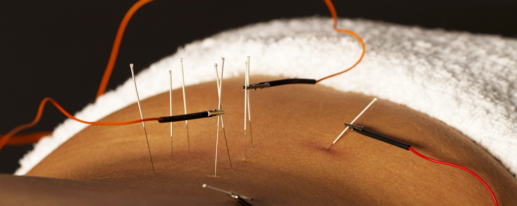 Osteopatia e Acupuntura - Nelson Costa