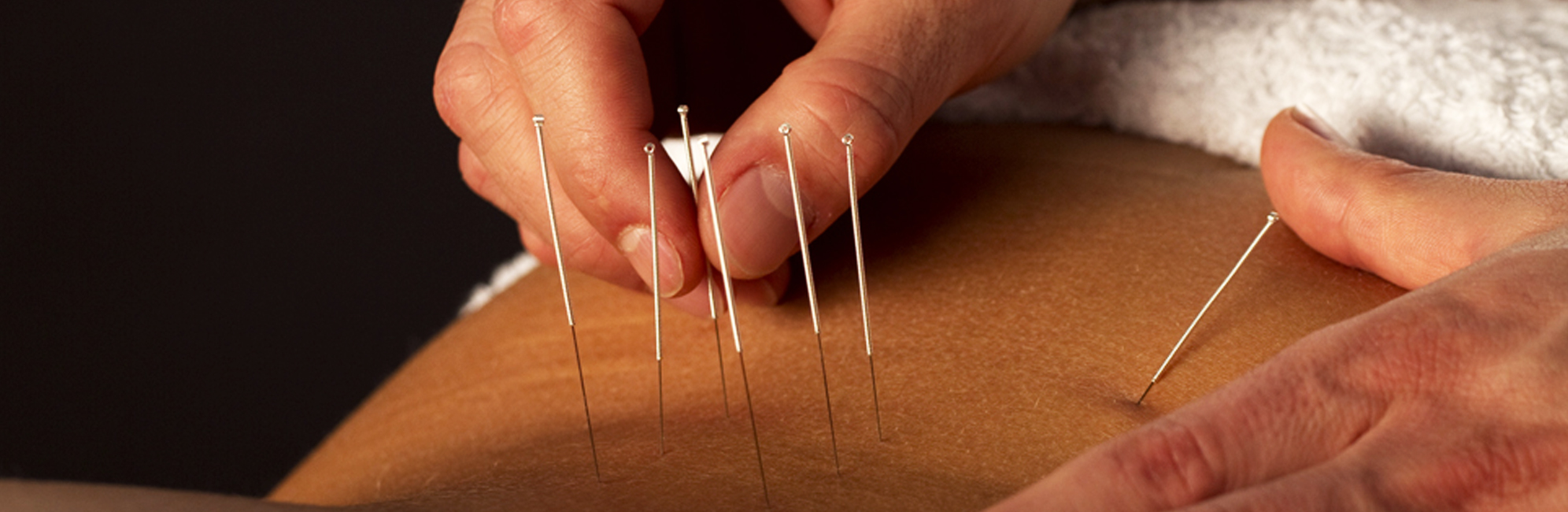 Osteopatia e Acupuntura - Nelson Costa